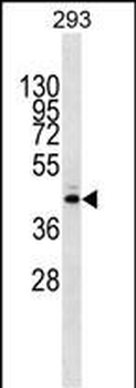 METTL2B Antibody (N-term)