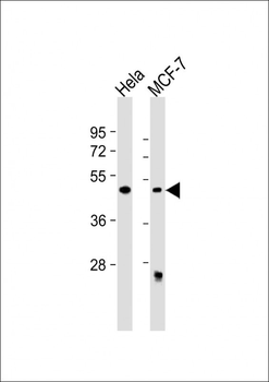 ALKBH5 Antibody (Center)