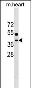 TTC35 Antibody (Center)