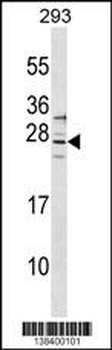 SIRPD Antibody (Center)