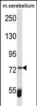 ZBTB39 Antibody (Center)
