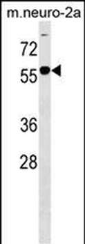 B4GALNT1 Antibody (Center)