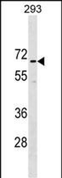 CCDC151 Antibody (N-term)