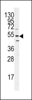 ATG14 Antibody (N-term)