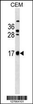 CB083 Antibody (C-term)