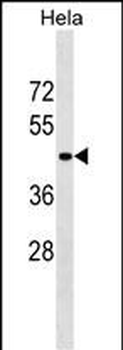 SERPINB11 Antibody (Center)