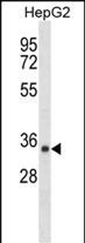 SDR39U1 Antibody (N-term)