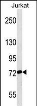 RPAP3 Antibody (Center)