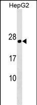 PLLP Antibody (N-term)
