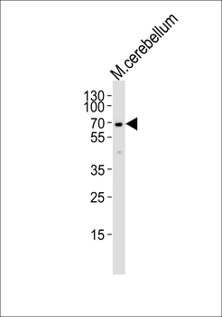 MTF2 Antibody (Center)