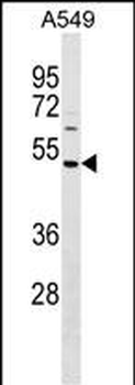 HAUS8 Antibody (N-term)