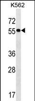 FRMD8 Antibody (N-term)