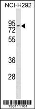 ZNF551 Antibody (Center)
