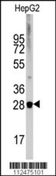 DRAM Antibody (N-term)