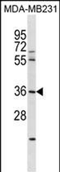 RNF217 Antibody (N-term)