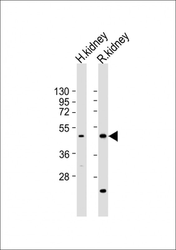 KCNK12 Antibody (C-term)