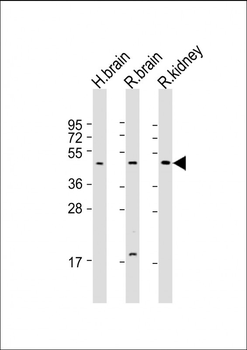KCNK12 Antibody (C-term)