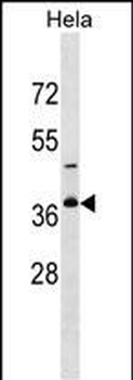 GOLPH3L Antibody (Center)