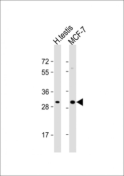 OR4M2 Antibody (C-term)