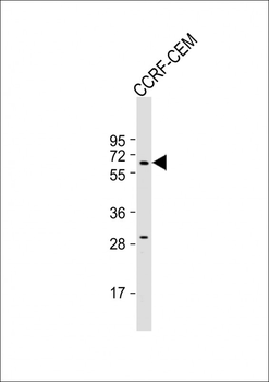 DYTN Antibody (C-term)