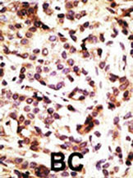 Beclin 1 Antibody