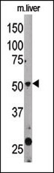 Beclin 1 Antibody