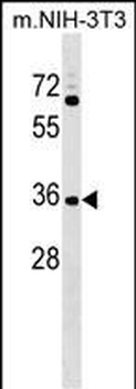 CCDC75 Antibody (N-term)