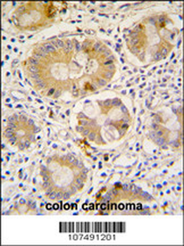 ATG16L Antibody (C-term)