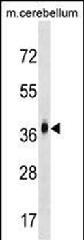 MMD2 Antibody (N-term)