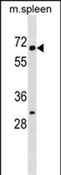 KLH22 Antibody (C-term)
