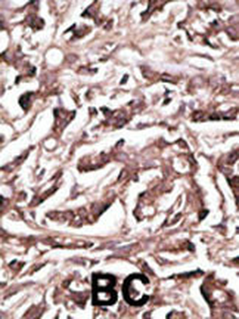 ATG7 Antibody (Center)