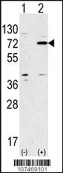 ATG7 Antibody (Center)