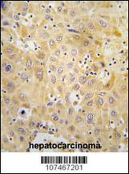 ATG7 Antibody (N-term)