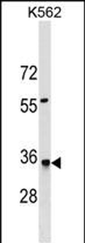HMGCL Antibody (N-term)