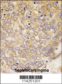 ATG4D Antibody (C-term)