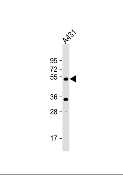 ATG4D Antibody (C-term)