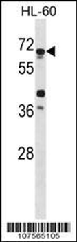 ATG4D Antibody (Center)