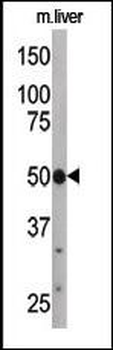 ATG4C Antibody (C-term)