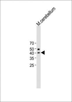QPCTL Antibody (C-term)