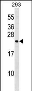 N6AMT1 Antibody (N-term)