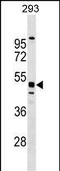 MTL5 Antibody (C-term)