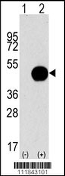 ATG4B Antibody