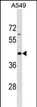 GPR62 Antibody (N-term)
