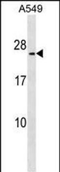 METTL7B Antibody (N-term)