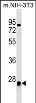 METTL7B Antibody (N-term)