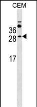 MS4A3 Antibody (Center)