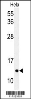 LC3 Antibody (APG8C) (T48)