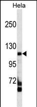 FAM65C Antibody (C-term)