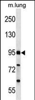 FCHO2 Antibody (Center)