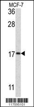 APG8b (MAP1LC3B)-T93/Y99 Antibody (Center)